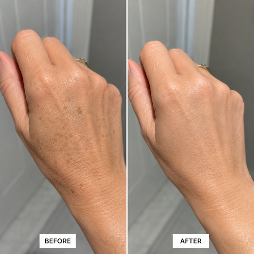 Spot Reducing Body Cream
